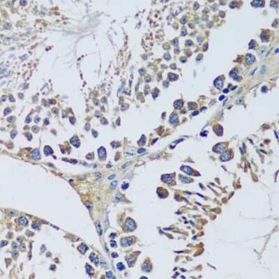 Immunohistochemistry-Paraffin: BLOS3 Antibody - BSA Free [NBP3-03343]